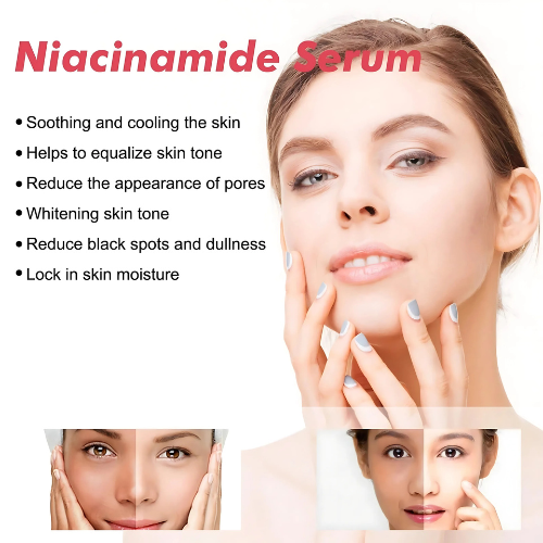 Niacinamide Zinc Oil for Skin Glow